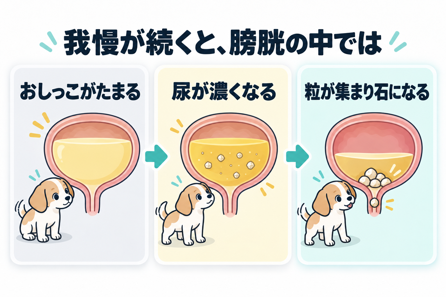 我慢が続くと膀胱の中では、おしっこがたまり、尿が濃くなり、粒が集まって石になる。